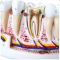 Anatomia do Dente e Mandíbula Inferior de um Jovem 6 Partes-491e0908-6fca-4dd8-a64c-3b3b7b920f47