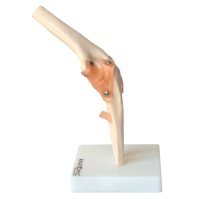 Articulação do Cotovelo Com Ligamentos-79bb8cb4-4ab7-4db8-ac31-25ba442c5d2e