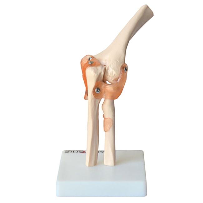 Articulação do Cotovelo Com Ligamentos-0ef5fdb9-f0a8-4571-abd4-fcad30c181e0