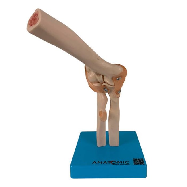 Articulação do Cotovelo Com Ligamentos-52ea6855-22a7-492b-acf3-7e57c7f55b4a