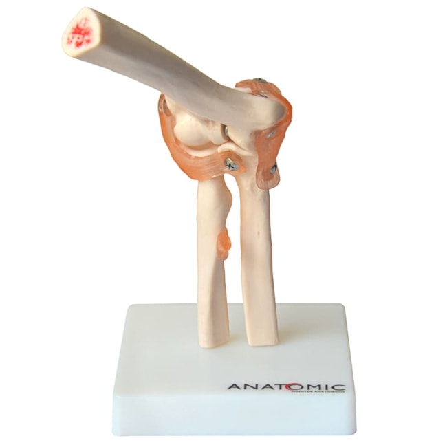 Articulação do Cotovelo Com Ligamentos-df3737cf-b619-44e9-9253-4782651f31ef
