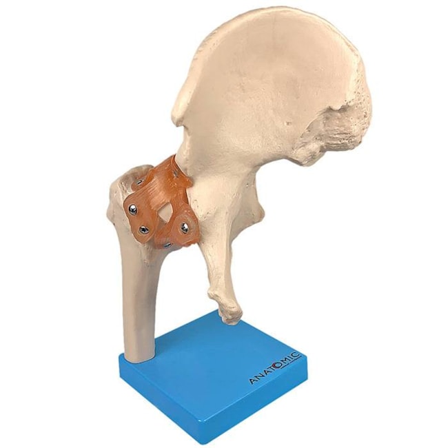Articulação do Quadril com Ligamentos-9ccc5d93-90b6-4f68-8d48-6d7e3c08fc99