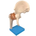 Articulação do Quadril com Ligamentos-0d7ddd8f-8ac0-4263-bea9-75df66e5dea6