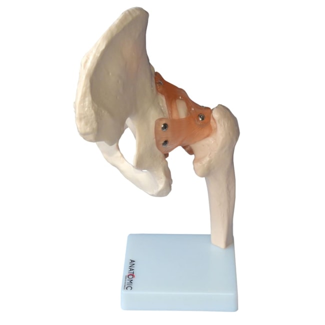 Articulação do Quadril com Ligamentos-a260bfd2-913c-4f4e-b1f7-682ccd803f45