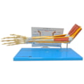 Braço com Ossos Músculos Ligamentos e Nervos-5b562e48-dd3d-49b7-ba5a-b6cacb7c9ae8