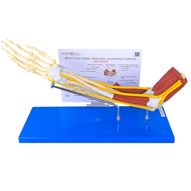 Braço com Ossos Músculos Ligamentos e Nervos-4d030bf5-b4b2-4720-bdea-4ee17a830f57
