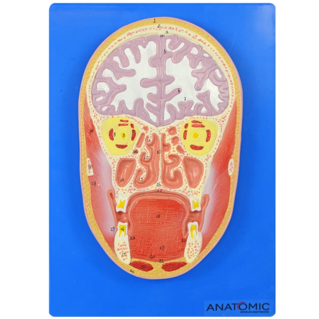 Cabeça em Corte Frontal-e6ee6456-1574-4548-b2a6-2e6d9be143ae