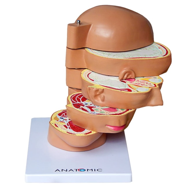 Cabeça em Disco Corte Axial-e8320c70-2948-4847-aced-f679b4f23255