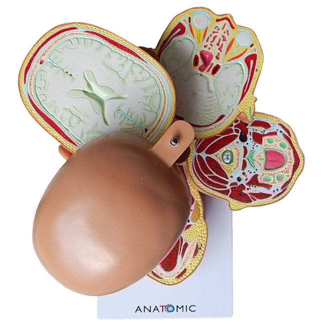 Cabeça em Disco Corte Axial-7e219154-458a-41e6-87a8-3090dbf1224c