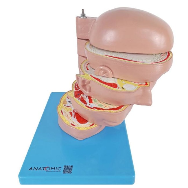 Cabeça em Disco Corte Axial-d3269b43-c6b5-4489-99fc-6978032d2c5b