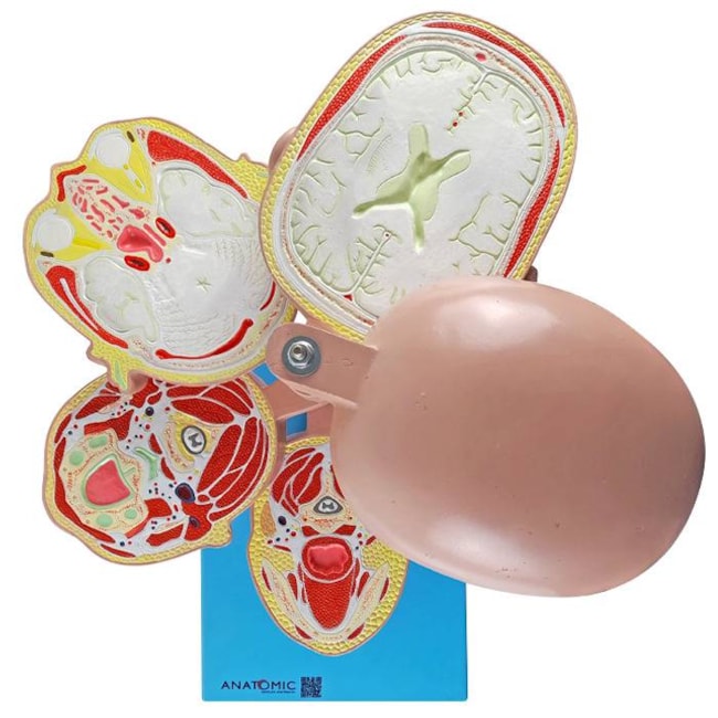 Cabeça em Disco Corte Axial-31f9fa89-9ac5-4b98-8be1-f9bd4efa19b4