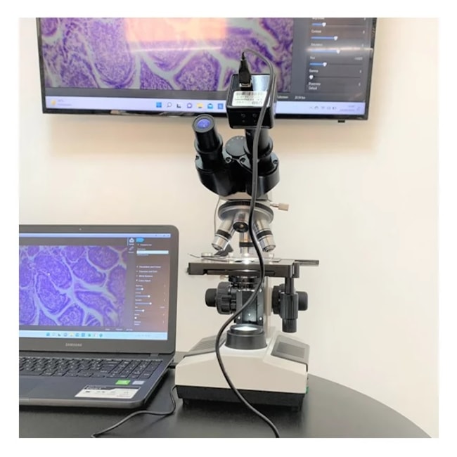 Câmera para Microscópio 5Mp-4297581d-cd92-4ee4-92d9-2874f33e4f39