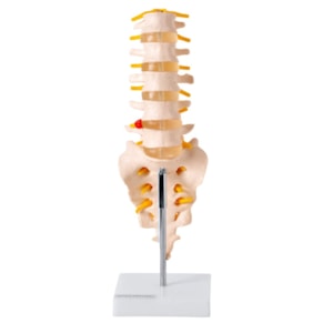 Coluna Vertebral Lombar