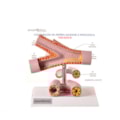 Comparação da Artéria Saudável e Patológica-c37ccf59-0328-4cc4-b2de-8796b1f04298
