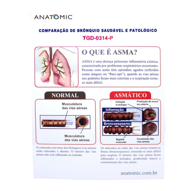 Comparação de Brônquio Saudável e Patológico-1fea7727-90e0-4f3e-9efd-ede245f02c8d