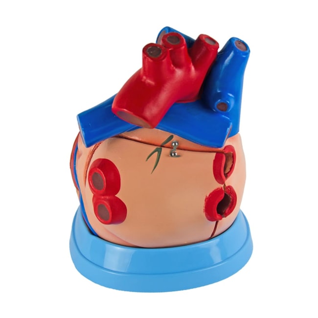 Coração Ampliado 5 Partes-6661e658-9cba-44da-b4c0-b3feaf3c8dc0