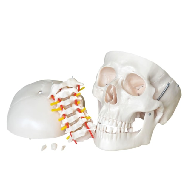 Crânio com Coluna Cervical-16d0000b-7596-4a0a-99ab-b20e37e4c1f8