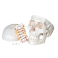 Crânio com Coluna Cervical-41a30961-3d95-4b48-9882-b331028baf0e