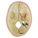 Crânio com Vasos Sanguíneos e Nervos Numerado 10 Partes