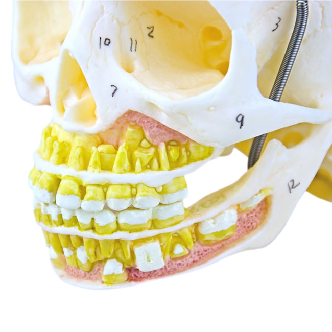 Crânio Infantil com Mandíbula Aberta 2 Partes-e5f79524-a7e4-411f-8e2a-fa42cc65e82c