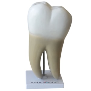 Dente Molar Ampliado com Evolução da Cárie 8 Partes