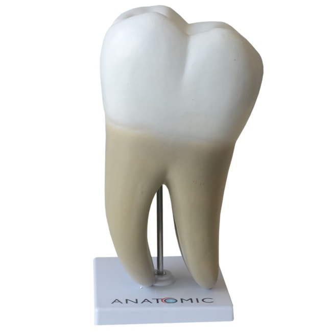 Dente Molar Ampliado com Evolução da Cárie 8 Partes-74c4f67d-89c8-41eb-9003-0a0e07032cbc