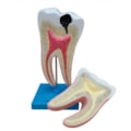 Dente Molar Ampliado Saudável e Cárie-3af5b20a-6fec-4b0d-8530-89249a2a9511