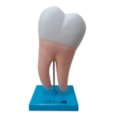 Dente Molar Ampliado Saudável e Cárie-a3e1fdda-6256-4db1-adab-429e07a23550