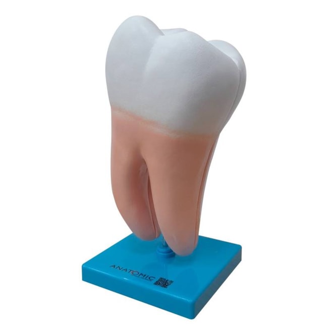 Dente Molar Ampliado Saudável e Cárie-46675276-feb9-4d29-8b66-a5290c056213