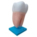 Dente Molar Ampliado Saudável e Cárie-12422e74-959e-48d1-ac2d-48731e94429e