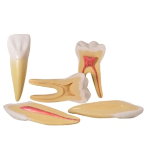 Dentes Ampliados Canino, Incisivo e Molar