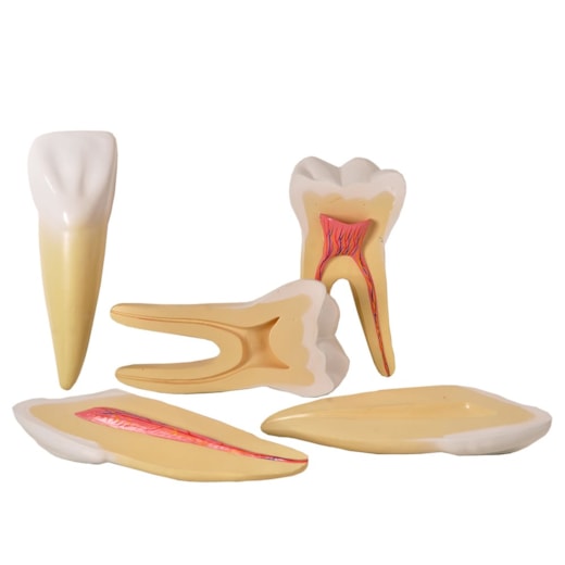 Dentes Ampliados Canino, Incisivo e Molar