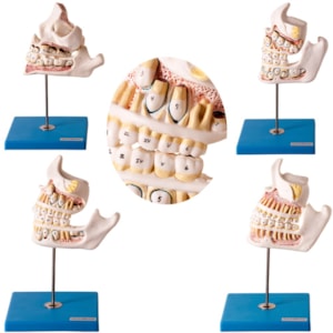 Desenvolvimento da Dentição 4 Partes