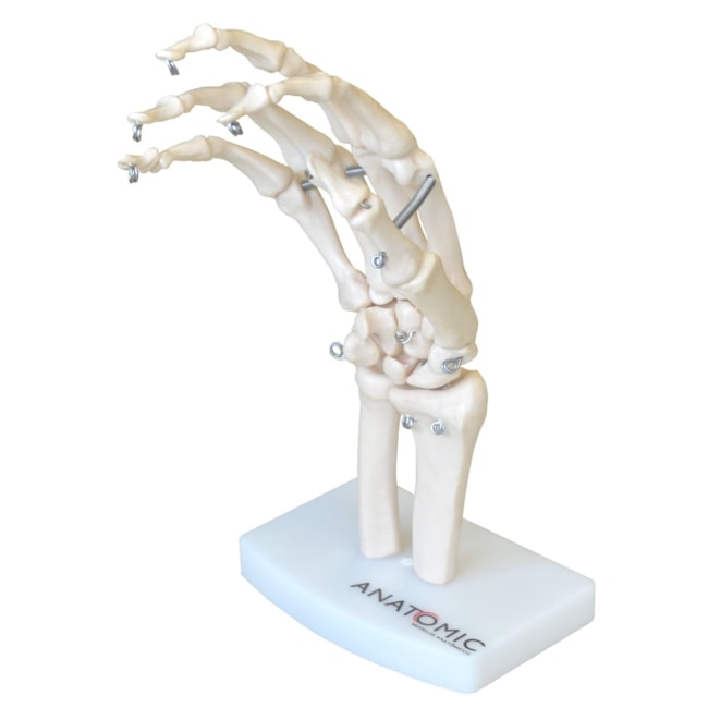 Esqueleto de Mão com Ossos do Punho-e84fcc01-e24f-43a5-9f31-97e1aefb3af7