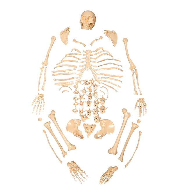 Esqueleto Humano Desarticulado-c6324ad2-acd6-434a-b95a-d14169f6dfc0