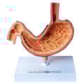 Estômago com Patologias-8d1f454c-ca15-450b-9b25-f4d9277c853b