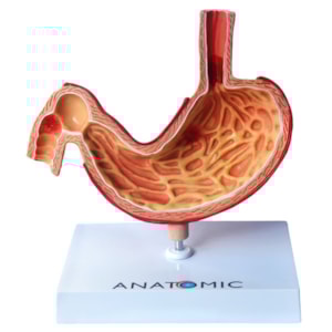Estômago com Patologias