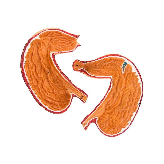 Estômago Luxo 2 partes-f7b98ba2-5f1b-437e-a81b-73c4534dec0d