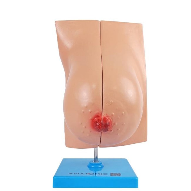 Glândula Mamária em Lactação-5483e68d-4e6e-4f3d-9fdf-be87004aa885