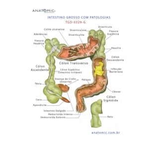 Intestino Grosso com Patologia