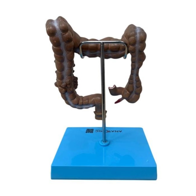Intestino Grosso com Patologia-d03e0df5-79c8-4f9a-b554-e3e5aa46408a