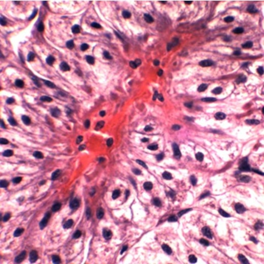 Lâminas Preparadas de Ensino Superior 100 peças