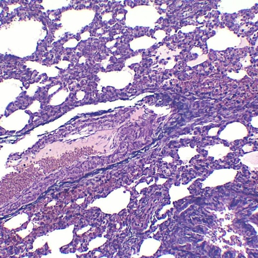 Lâminas Preparadas De Histologia 80 peças