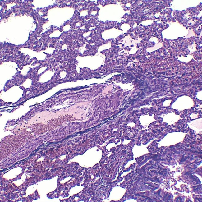 Lâminas Preparadas De Histologia 80 peças-76cd7576-1583-4048-b1ca-96df375690d4