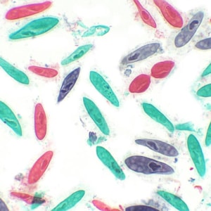 Lâminas Preparadas De Parasitologia 30 peças