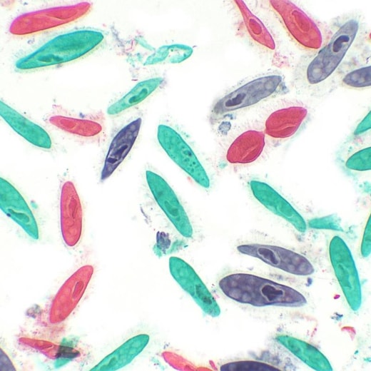 Lâminas Preparadas De Parasitologia 30 peças