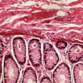 Lâminas Preparadas De Patologia 50 peças-9bc93a31-33a3-4cff-a87d-b21c53589130