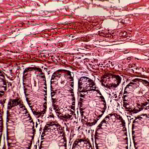 Lâminas Preparadas De Patologia 50 peças
