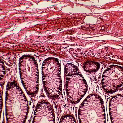 Lâminas Preparadas De Patologia 50 peças