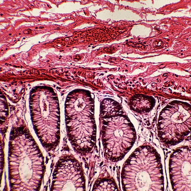 Lâminas Preparadas De Patologia 50 peças-53aec1cc-24f6-4aa4-bc86-d35f2bb81fd8